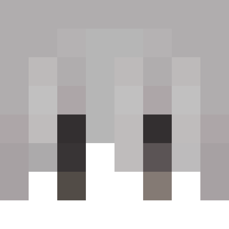 HT1SinceBirth's skin