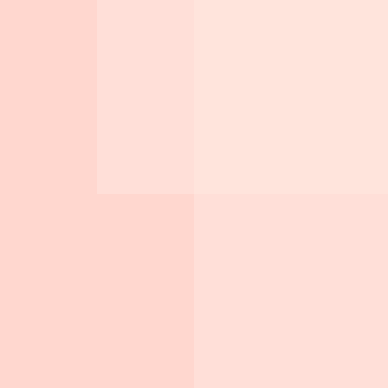 unventivetalent's skin