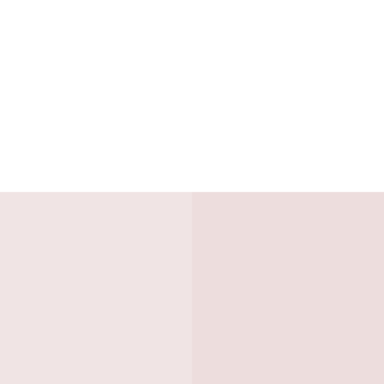 Respondents's skin
